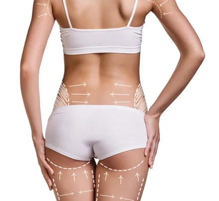 CHIRURGIE SILHOUETTE