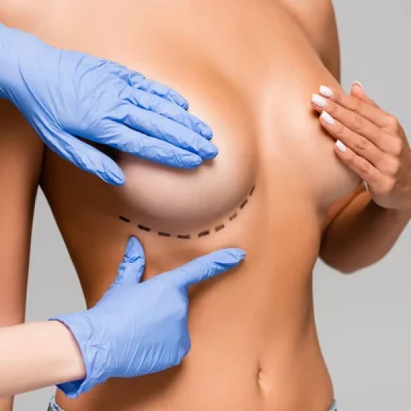 CHIRURGIE SEINS