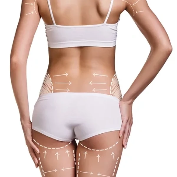 CHIRURGIE SILHOUETTE